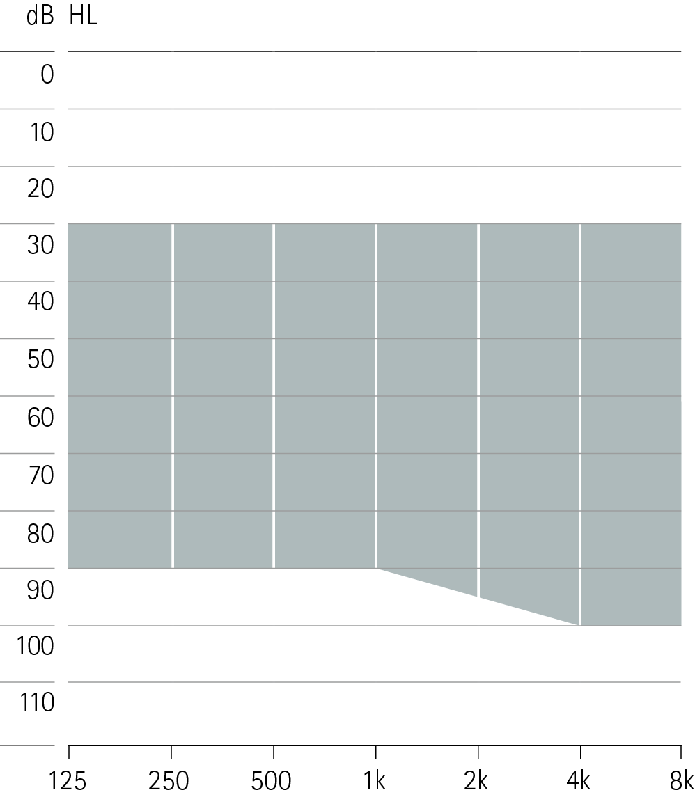 Fitting Range Phonak Naida Q Power xReceiver