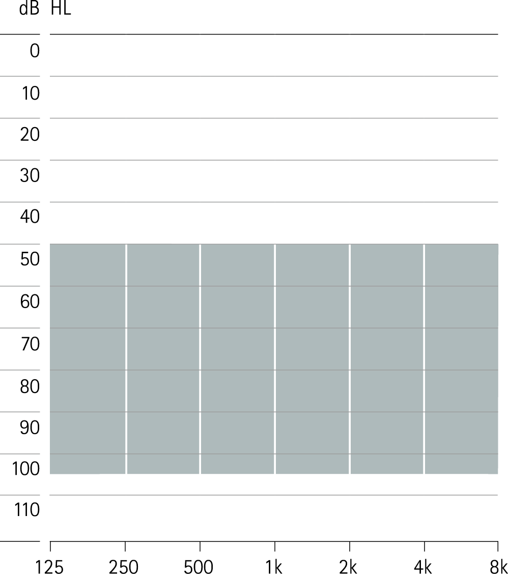 Fitting Range Phonak Naida Q SuperPower plus xReceiver