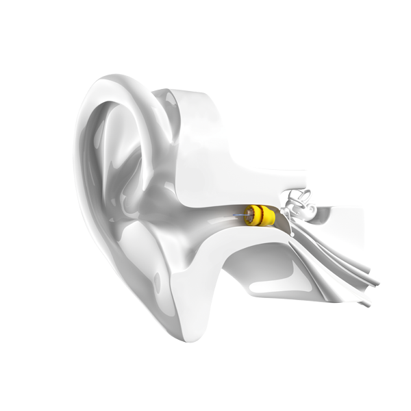 Pic_Lyric_Ear_Model_Glossy_Color.png